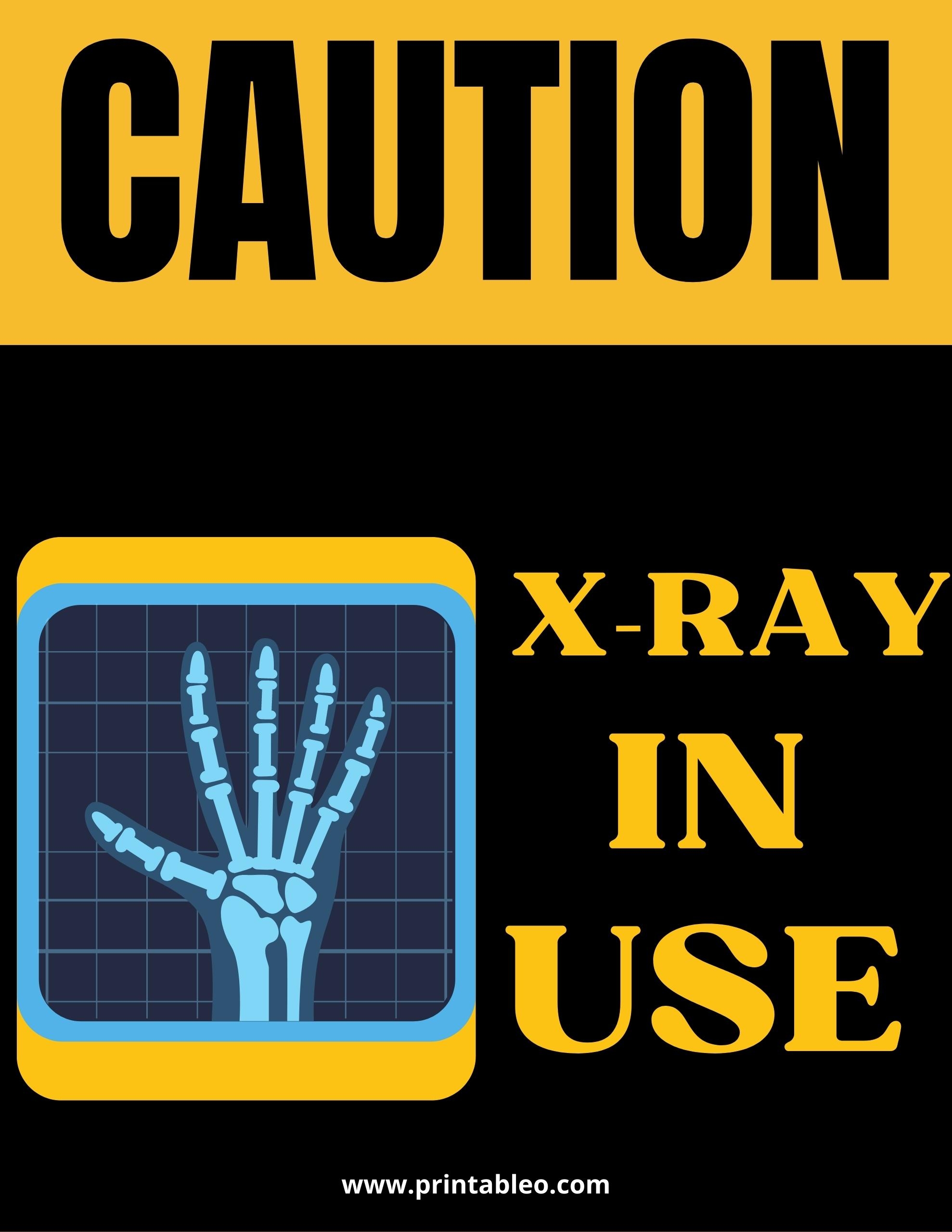 33 Printable X Ray Sign FREE PDF Printableo Com