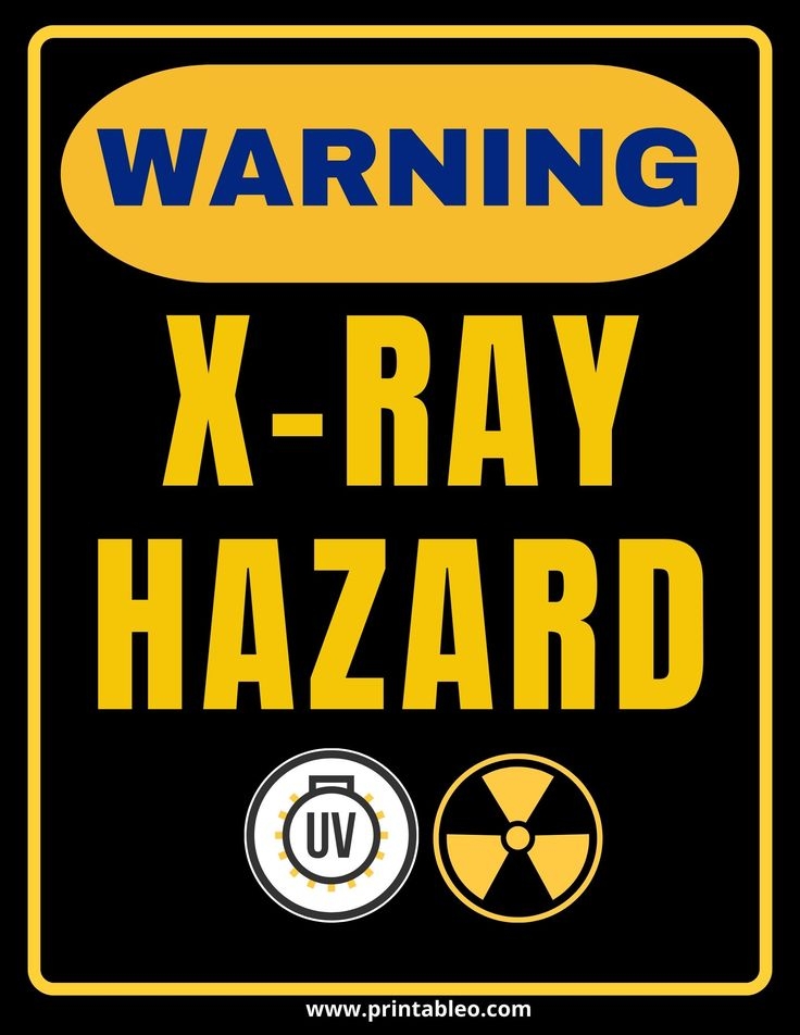 Free Printable X Ray Signs Download Free Printable X Ray Signs Png