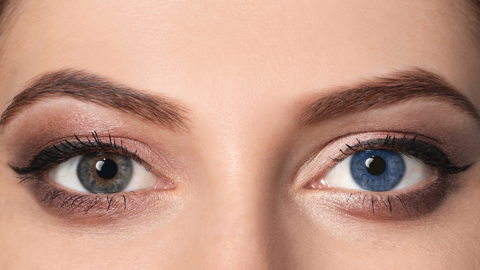 Is It Rare To Have Different Colored Eyes 